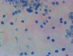 Macrolepiota ameriprocera