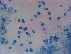 Macrolepiota ameriprocera