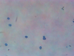 Macrolepiota ameriprocera