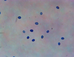 Macrolepiota ameriprocera