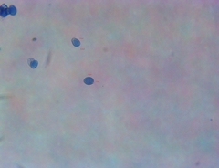 Macrolepiota ameriprocera