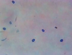 Macrolepiota ameriprocera