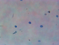 Macrolepiota ameriprocera