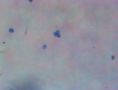 Macrolepiota ameriprocera