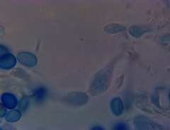 Macrolepiota ameriprocera