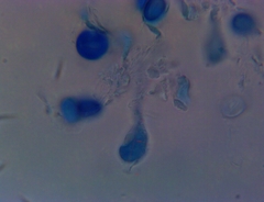 Macrolepiota ameriprocera