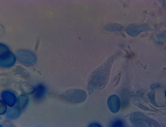 Macrolepiota ameriprocera