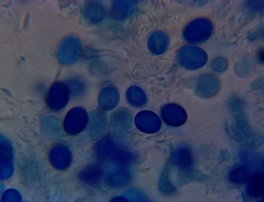 Macrolepiota ameriprocera