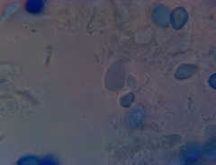 Macrolepiota ameriprocera