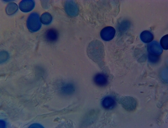 Macrolepiota ameriprocera