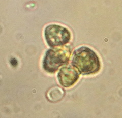 Coelastrum