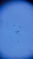 Caenorhabditis elegans