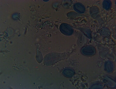 Macrolepiota ameriprocera