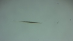 Aphanizomenon flosaquae