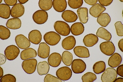 Puccinia taraxaci