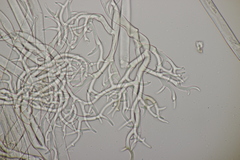 Peronospora verbenae