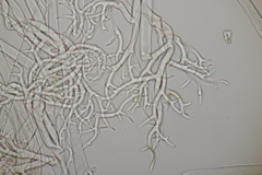 Peronospora verbenae