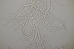 Peronospora verbenae