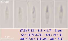 Orbilia luteorubella