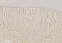 Orbilia luteorubella