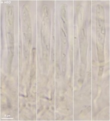 Orbilia luteorubella