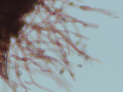 Botryobasidium conspersum