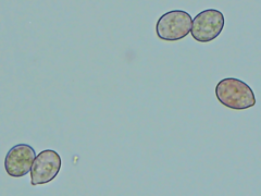 Botryobasidium conspersum