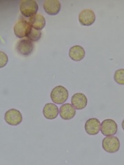 Stemonitopsis hyperopta