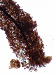 Stemonitopsis hyperopta