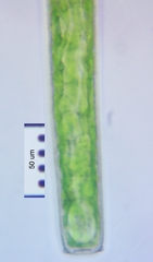 Pleurotaenium trabecula