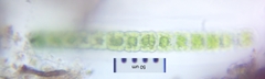 Hyalotheca