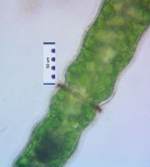 Pleurotaenium nodulosum