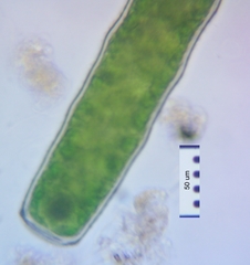 Pleurotaenium nodulosum