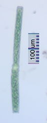 Pleurotaenium