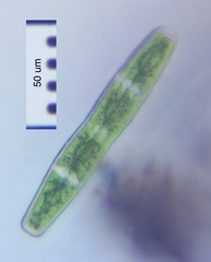 Penium spirostriolatum