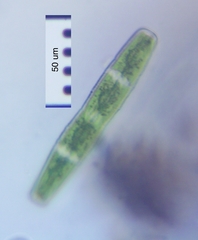 Penium spirostriolatum