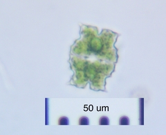 Euastrum denticulatum