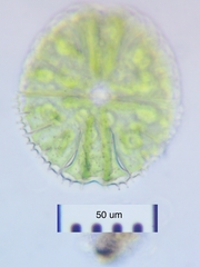 Micrasterias conferta
