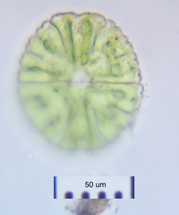 Micrasterias conferta