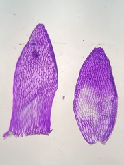 Sphagnum angermanicum