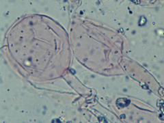 Trechispora mollusca