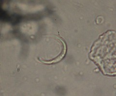 Monoraphidium contortum