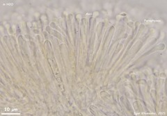 Orbilia luteorubella