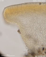 Orbilia luteorubella