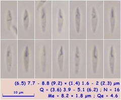 Orbilia luteorubella