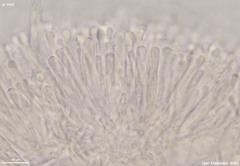 Orbilia luteorubella