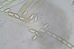 Peziza echinospora