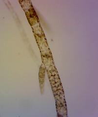 Feldmannia mitchelliae