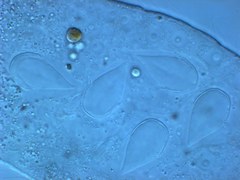 Austrognathiidae