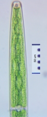 Closterium baillyanum